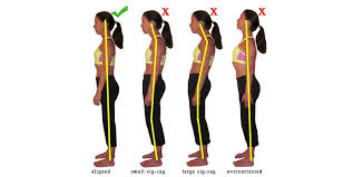 Kesehatan Tulang Belakang Panduan Gen Z Biar Gak Bungkuk, Sakit Pinggang, dan Tetap Tegak Sepanjang Hari